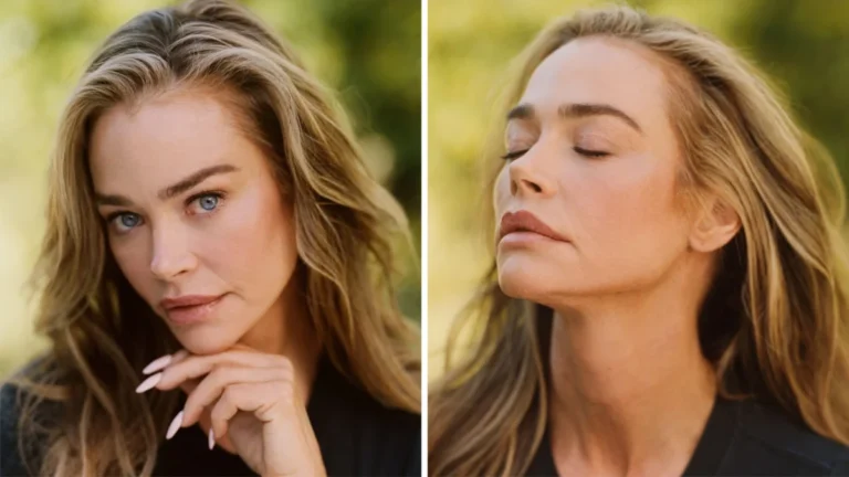 Denise Richards Opens Up About Her Facelift