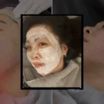 Seoul’s Beauty Boom: A Comprehensive Guide to Navigating the Cutting-Edge Treatments and Unbeatable Value