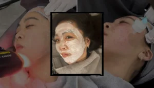 Seoul’s Beauty Boom: A Comprehensive Guide to Navigating the Cutting-Edge Treatments and Unbeatable Value