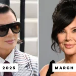 The Ongoing Spectacle of Kris Jenner’s Facelift: Examining the Speculation and Surgical Realities