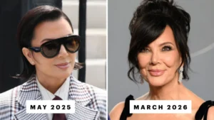 The Ongoing Spectacle of Kris Jenner’s Facelift: Examining the Speculation and Surgical Realities