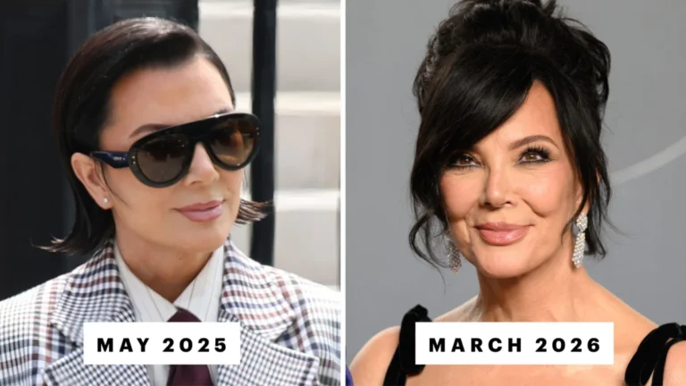 The Unfolding Narrative of Kris Jenner’s Facelift: Speculation, Science, and the Shifting Landscape of Celebrity Aesthetics