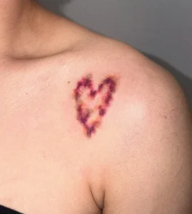 The Emergence of Bruise-Like Tattoos: A Deep Dive into a Polarizing Aesthetic Trend