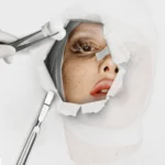 The Unvarnished Truth: A Deep Dive into Facelift Recovery and Its Surprising Realities