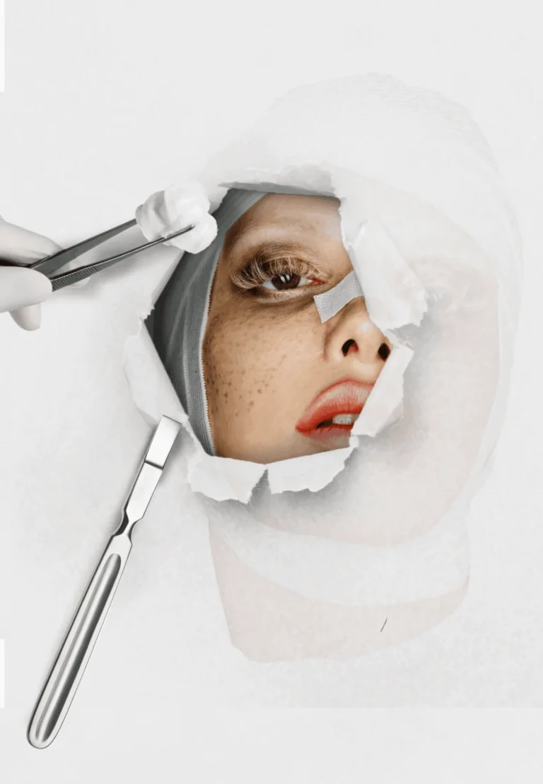 The Unvarnished Truth: A Deep Dive into Facelift Recovery and Its Surprising Realities