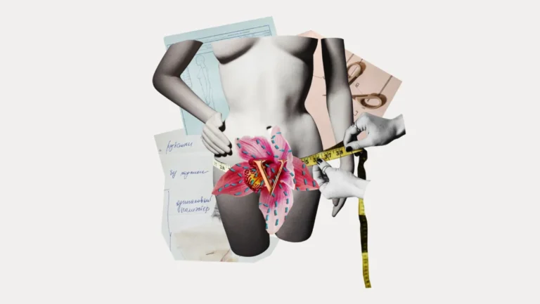 The Hidden Reality of Labiaplasty: Beyond the "Designer Vagina" Label