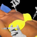 The Rise of Melanotan II: A Banned Peptide Promising a Tan, But Posing Serious Health Risks