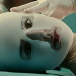 From unrealistic visualisations to the chat-driven clinic: inside the new era of AI-influenced aesthetic medicine