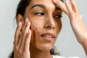 Managing the Dual Burden of Eczema and Milia: A Clinical Guide to Balancing Skin Health