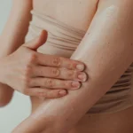 Navigating Skin Care and Lifestyle Choices While Living With Psoriasis